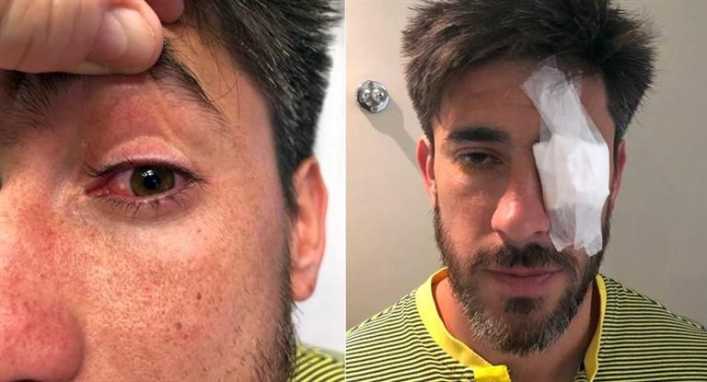 Boca difundió las imágenes de la lesión en el ojo de Pablo Pérez