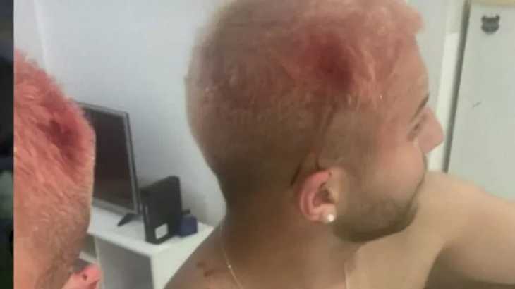 VIDEO: Incidentes en Río de Janeiro: varios hinchas de Boca fueron agredidos por gente de Fluminense